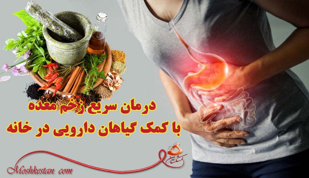 درمان سریع زخم معده با کمک گیاهان دارویی در خانه