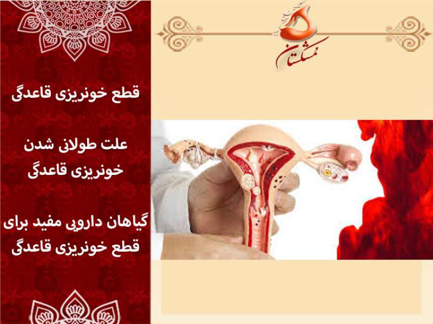 قطع خونریزی قاعدگی