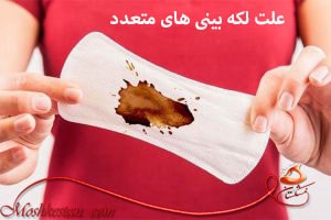 پریود طولانی و لکه بینی