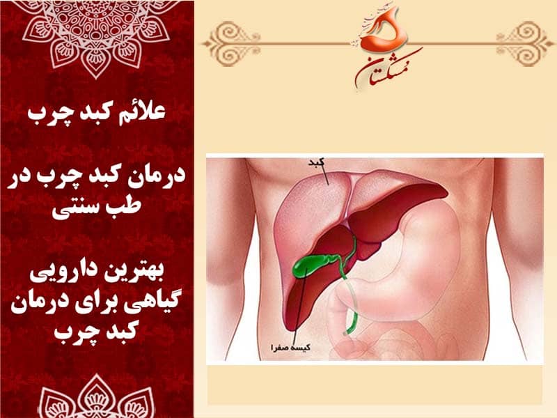 کبد چرب