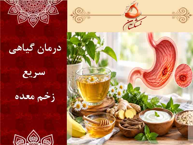 درمان سریع زخم معده